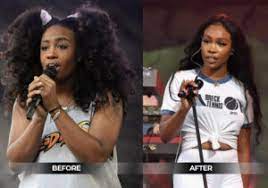 sza weight loss before After