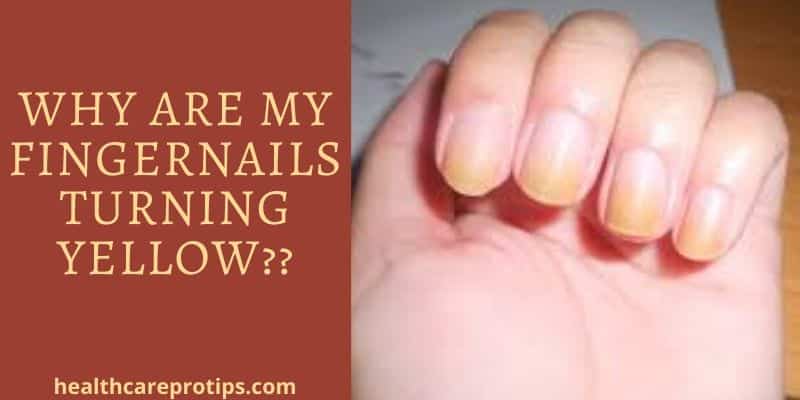 why-are-my-nails-yellow-glaize