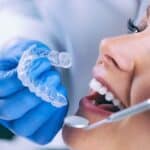 Invisalign Dentist