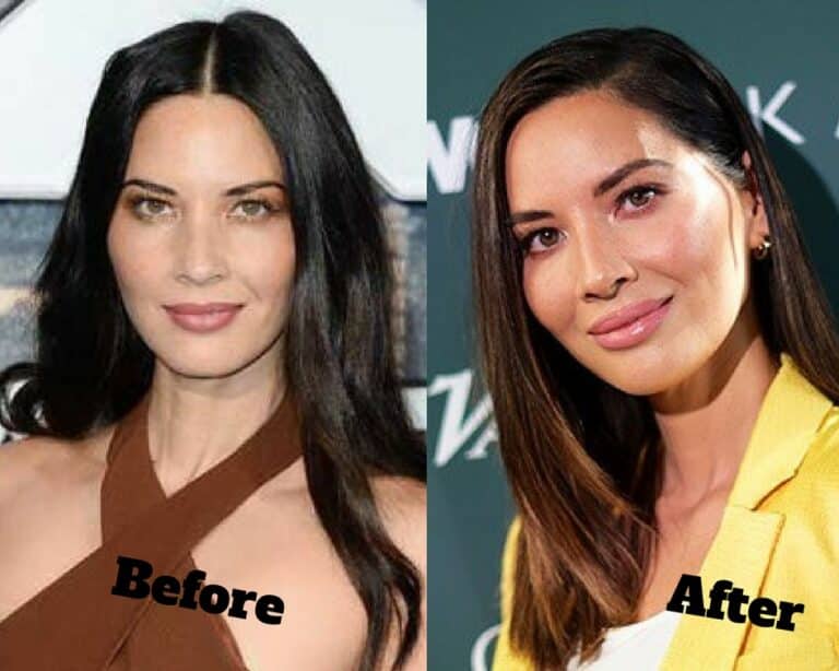 Olivia Munn Plastic Surgery Transformation