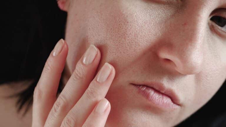 Six Causes of Dry Skin and Ways to Prevent It