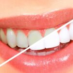 Professionals Tips for Better White Teeth and a Smile!