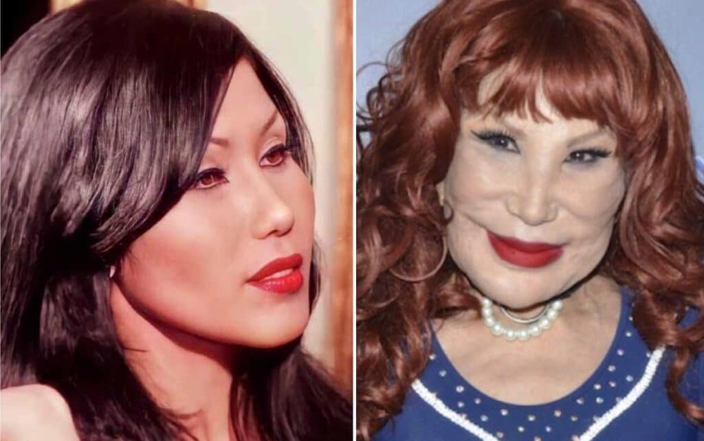 Lyn May Plastic Surgery Let’s Reveal All about It!