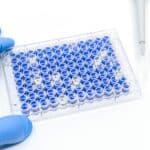 What Is The Major Advantage Of ELISA
