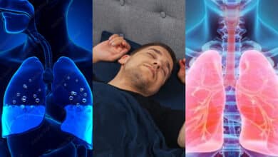 How to Sleep with Fluid Lungs